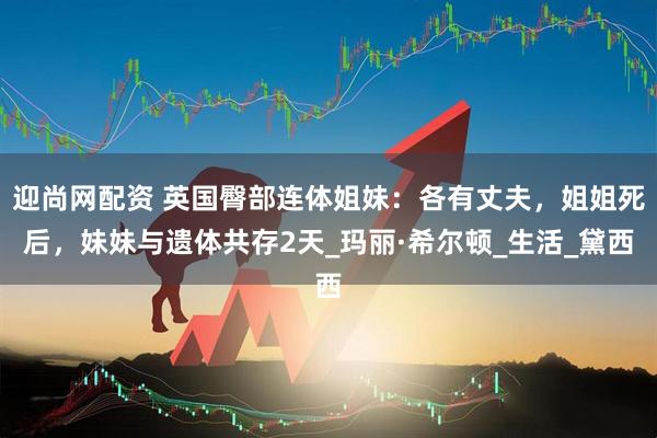 迎尚网配资 英国臀部连体姐妹：各有丈夫，姐姐死后，妹妹与遗体共存2天_玛丽·希尔顿_生活_黛西